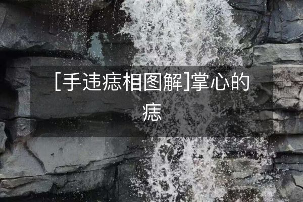 [手違痣相圖解]掌心的痣