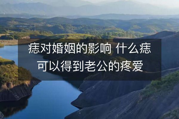痣對婚姻的影響 什么痣可以得到老公的疼愛